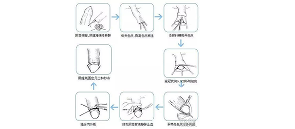 中山市正规医院割包皮多少钱?